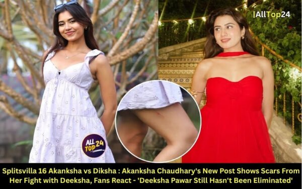 Splitsvilla 16 Akanksha vs Diksha : Akanksha Chaudhary's New Post Shows Scars From Her Fight with Deeksha